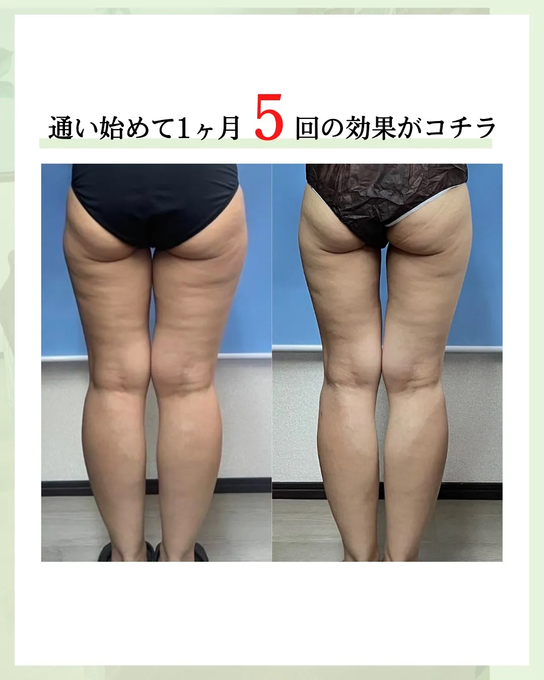 他の投稿はこちら @hibarigaoka_kino