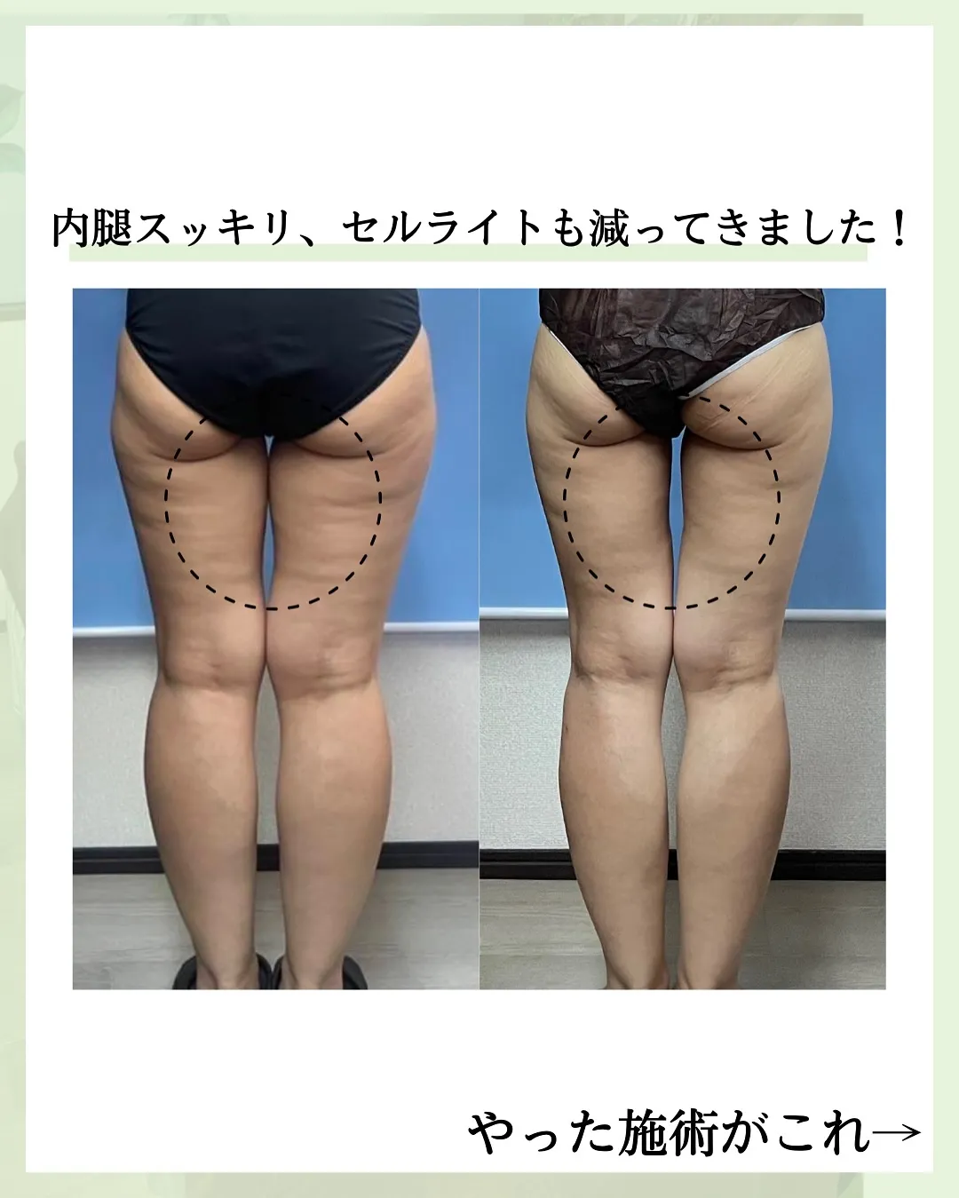 他の投稿はこちら @hibarigaoka_kino