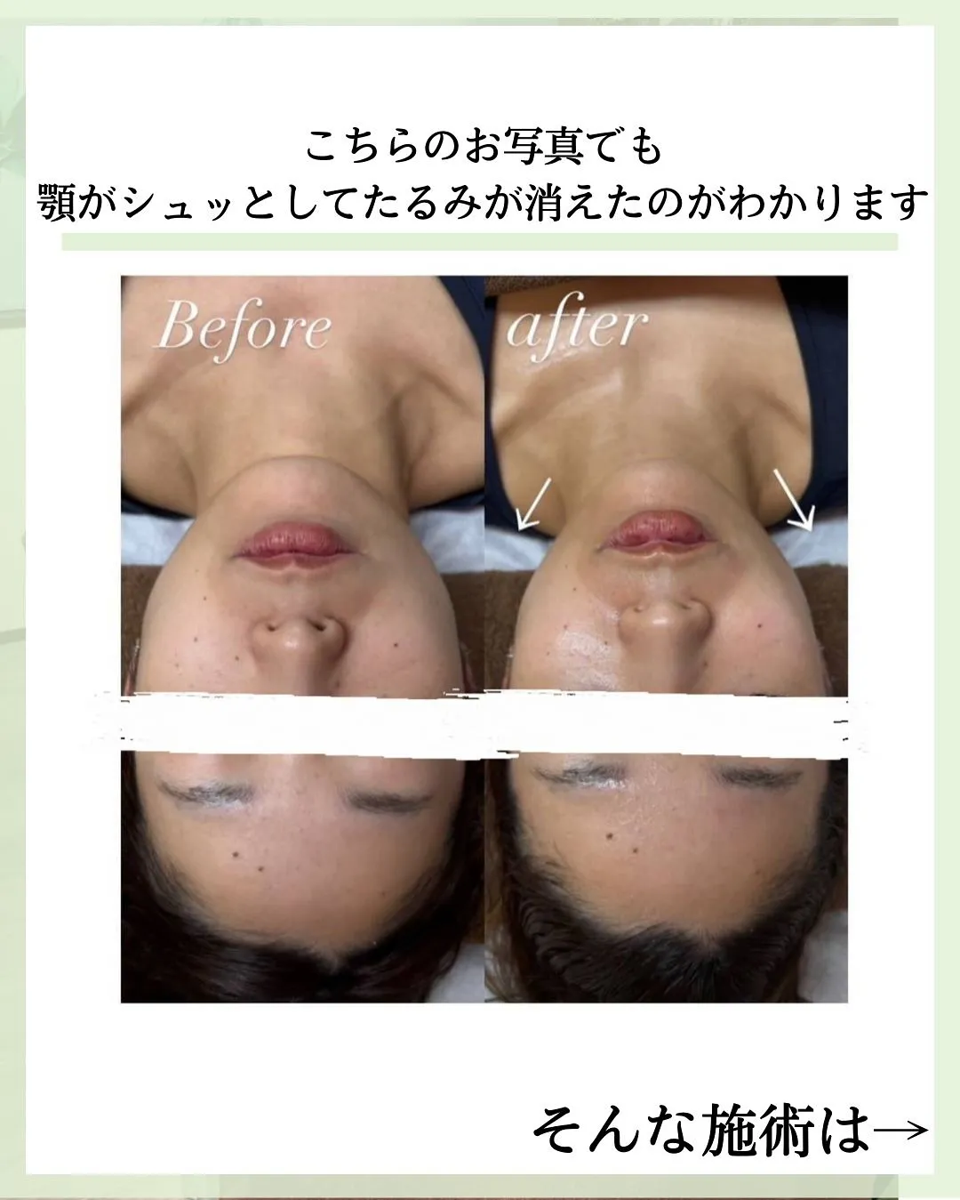 他の投稿はこちら @hibarigaoka_kino