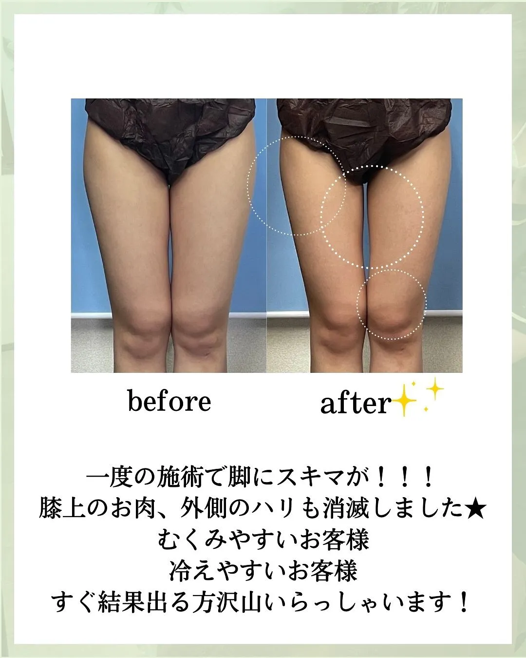 他の投稿はこちら @hibarigaoka_kino