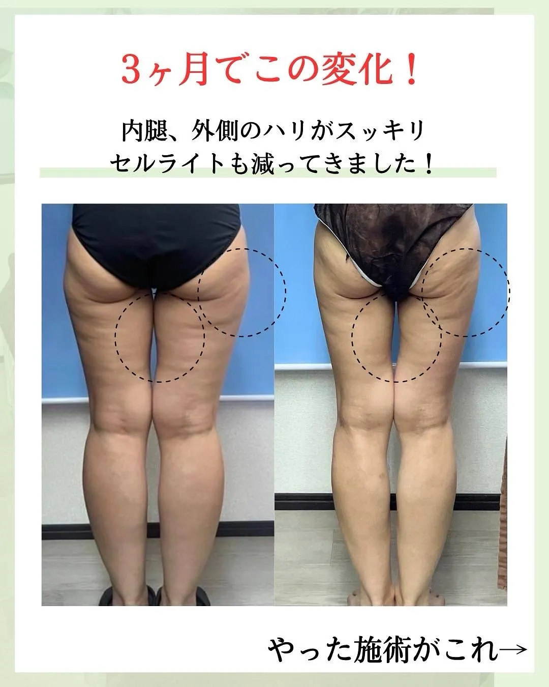 他の投稿はこちら @hibarigaoka_kino