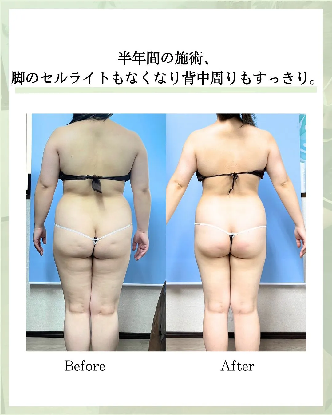 他の投稿はこちら @hibarigaoka_kino