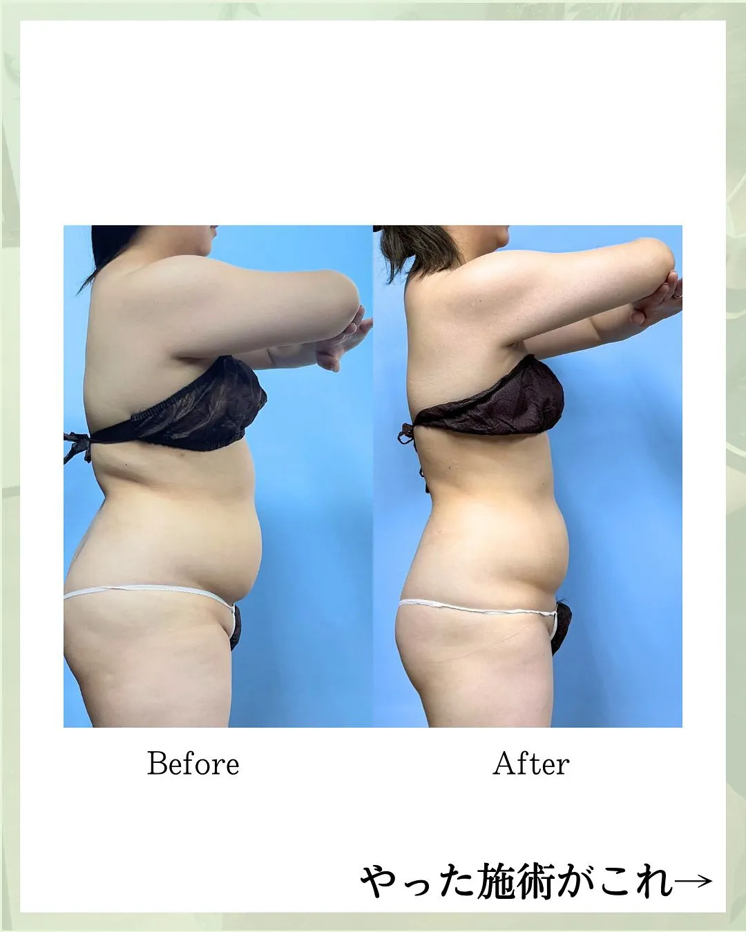 他の投稿はこちら @hibarigaoka_kino