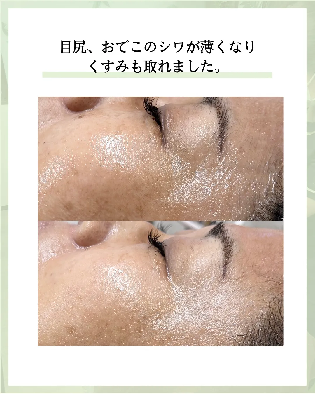 他の投稿はこちら @hibarigaoka_kino