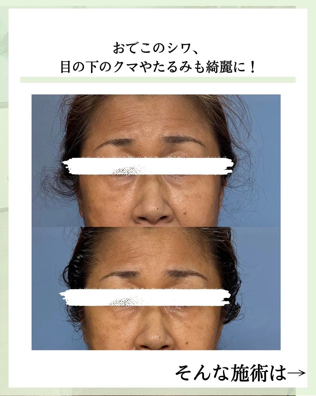 他の投稿はこちら @hibarigaoka_kino