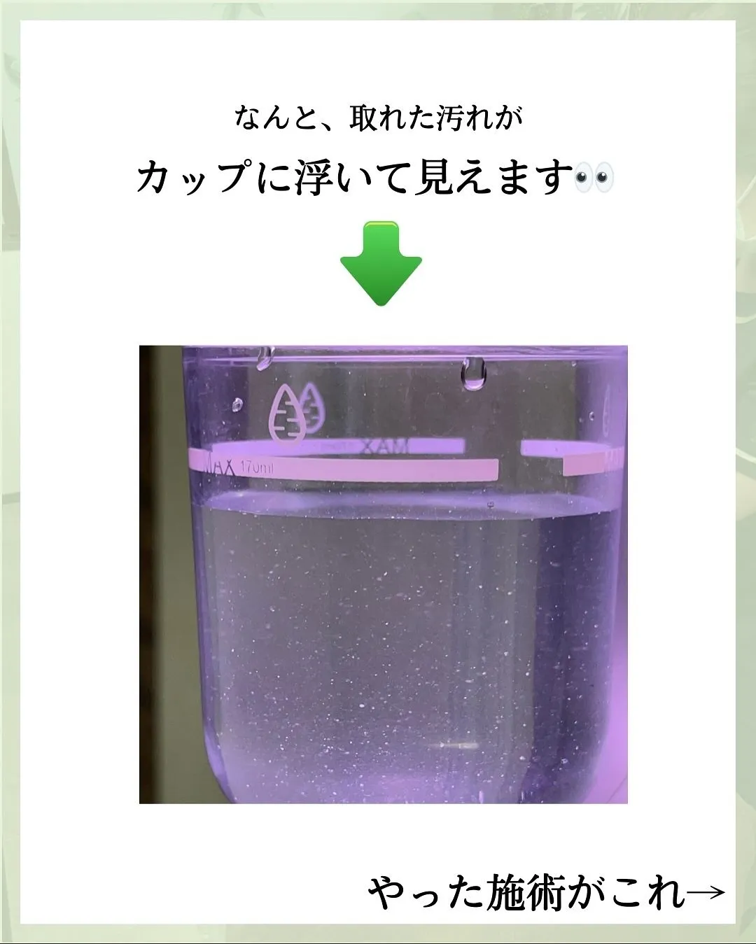 他の投稿はこちら @hibarigaoka_kino