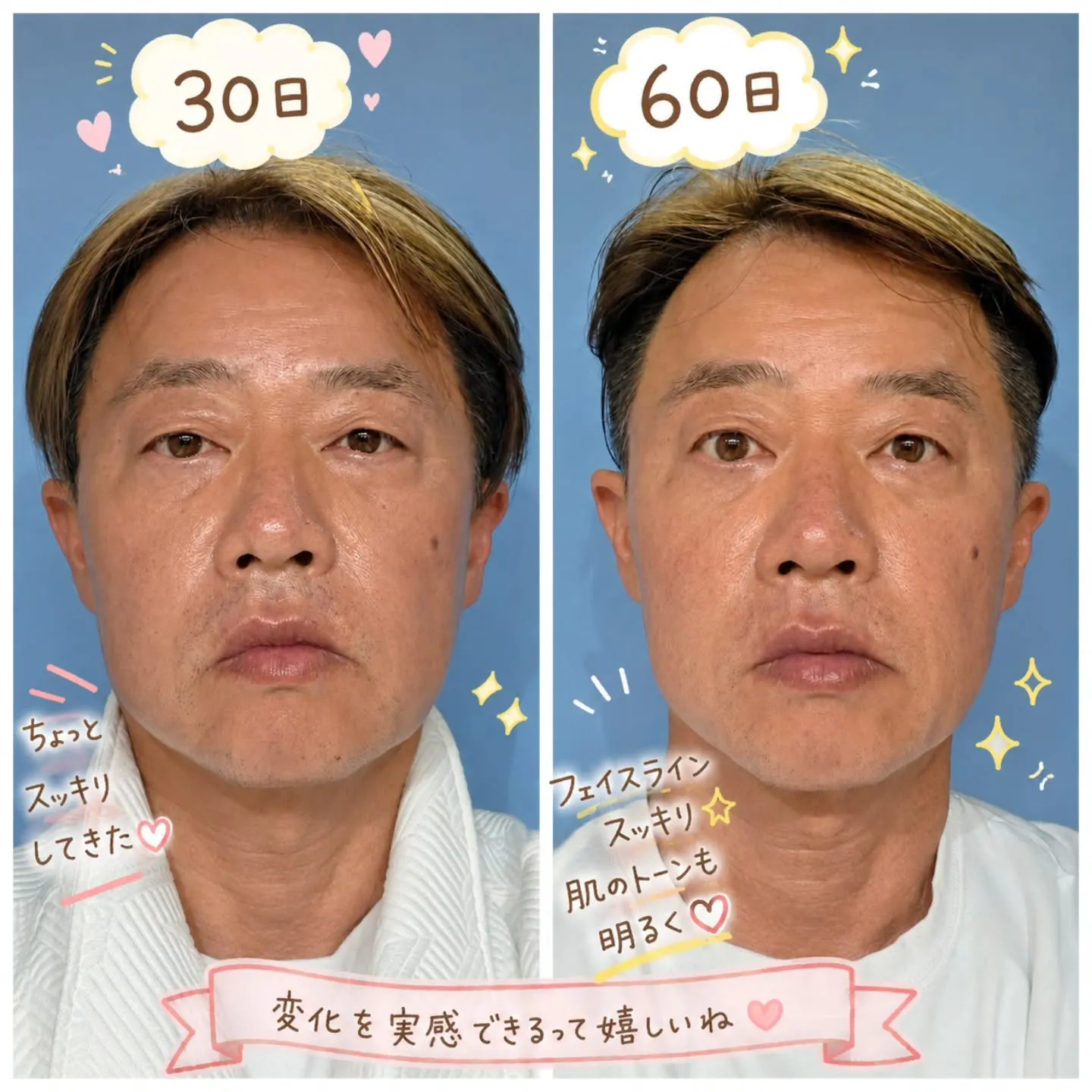 インセルダム30日→60日✨
